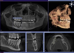 Full and side view examples of Cone Beam CT Scanner images